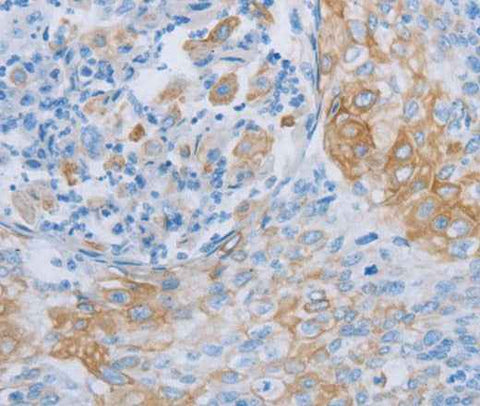 Anti-Human ADRB3 Antibody
