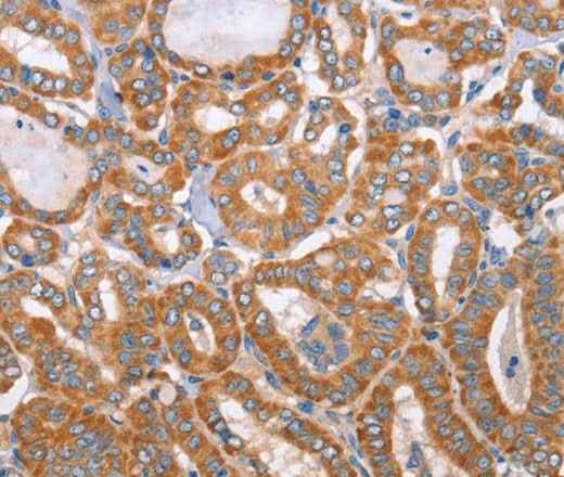 Anti-Human/Mouse MTMR7 Antibody