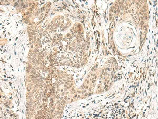 Anti-Human/Mouse/Rat GPSM1 Antibody