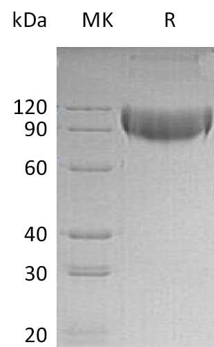 Recombinant Mouse L-Selectin/SELL Protein (His Tag) - ABMIUM