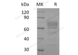 Recombinant Human Podoplanin/PDPN Protein (Fc Tag) - ABMIUM