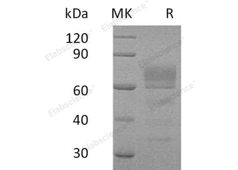 Recombinant Human Podoplanin/PDPN Protein (Fc Tag) - ABMIUM