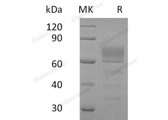 Recombinant Human Podoplanin/PDPN Protein (Fc Tag) - ABMIUM