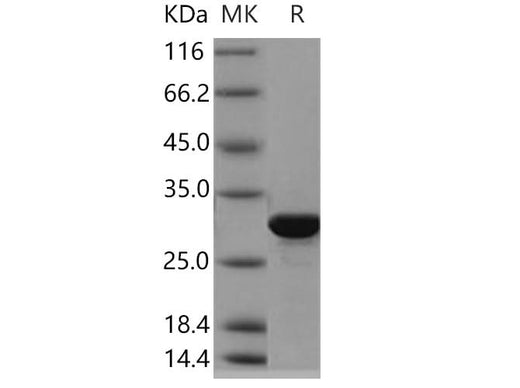 Recombinant Human BPHL Protein (His Tag) - ABMIUM