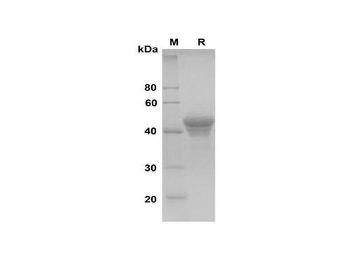 SDS-PAGE analysis of Human ApoA4 proteins, 2 μg/lane of Recombinant Human ApoA4 proteins was resolved with SDS-PAGE under reducing conditions, showing bands at 45 kDa.