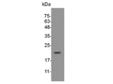 Recombinant Mouse BAFF protein(His Tag) - ABMIUM