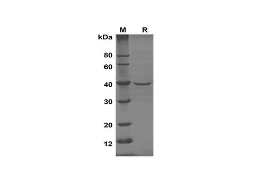 SDS-PAGE analysis of Mouse CXCL1 proteins, 2 μg/lane of Recombinant Mouse CXCL1 proteins was resolved with SDS-PAGE under reducing conditions, showing bands at 40 kDa.