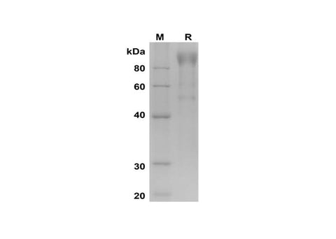 SDS-PAGE analysis of Human VCAM-1/CD106 proteins, 2 μg/lane of Recombinant Human VCAM-1/CD106 proteins was resolved with SDS-PAGE under reducing conditions, showing bands at 100 kDa.