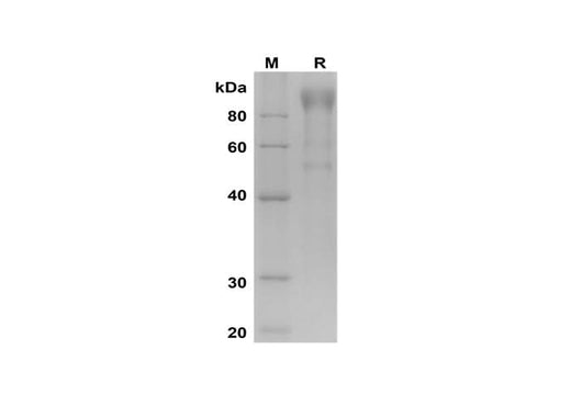 SDS-PAGE analysis of Human VCAM-1/CD106 proteins, 2 μg/lane of Recombinant Human VCAM-1/CD106 proteins was resolved with SDS-PAGE under reducing conditions, showing bands at 100 kDa.