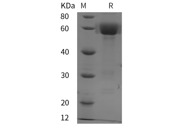 SDS-PAGE analysis of Mouse DKK3 proteins, 2 μg/lane of Recombinant Mouse DKK3 proteins was resolved with SDS-PAGE under reducing conditions, showing bands at 60 kDa.