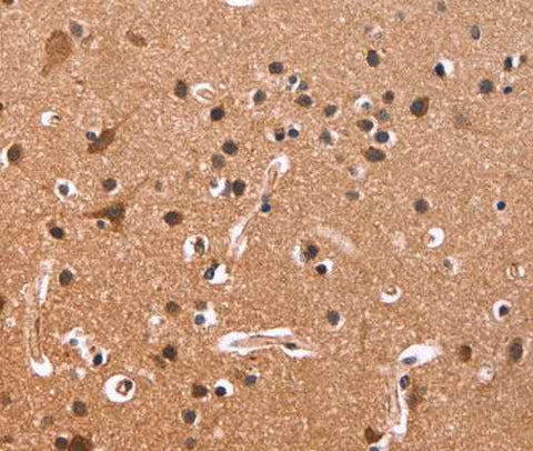 Anti-Human/Mouse/Rat CSNK1D Antibody