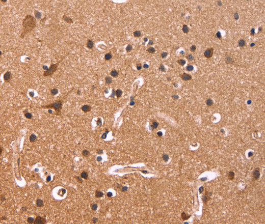 Anti-Human/Mouse/Rat CSNK1D Antibody - ABMIUM