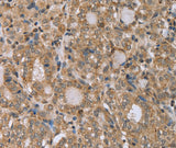 Anti-Human/Mouse RAB39B Antibody - ABMIUM