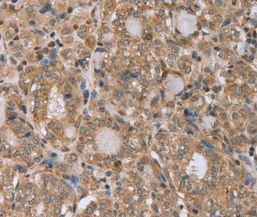 Anti-Human/Mouse RAB39B Antibody