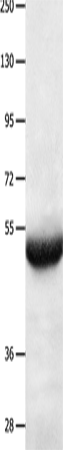 Anti-Human BPIFB3 Antibody - ABMIUM