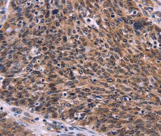 Anti-Human/Mouse/Rat CDC5L Antibody