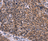 Anti-Human/Mouse/Rat CDC5L Antibody - ABMIUM
