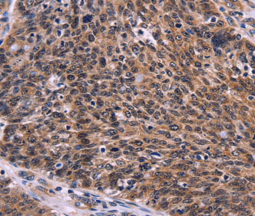 Anti-Human/Mouse/Rat CDC5L Antibody - ABMIUM