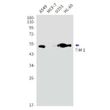 Western blot detection of TIM 1 in A549,MCF-7,U251,HL-60 cell lysates using TIM 1 Rabbit mAb(1:1000 diluted).Predicted band size:39kDa.Observed band size:50kDa.