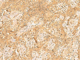 Immunohistochemistry of paraffin-embedded Human ovarian cancer tissue using TRMT112 Polyclonal Antibody at dilution of 1:30(×200)