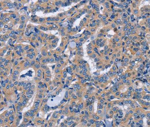 Anti-Human NCR2 Antibody