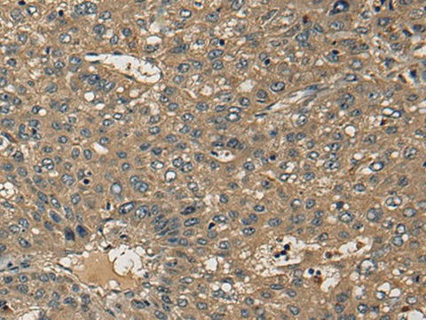 Anti-Human CD1B Antibody - ABMIUM