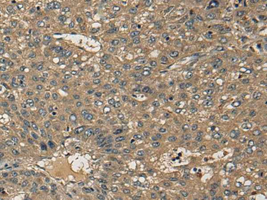 Anti-Human CD1B Antibody - ABMIUM