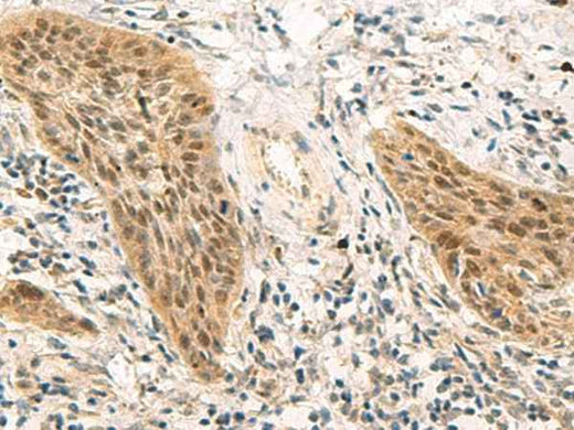 Anti-Human/Mouse/Rat PSME1 Antibody