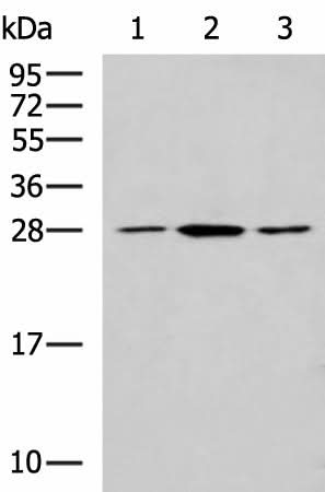 Western blot analysis of NIH/3T3 LO2 and Jurkat cell lysates using CLTB Polyclonal Antibody at dilution of 1:800