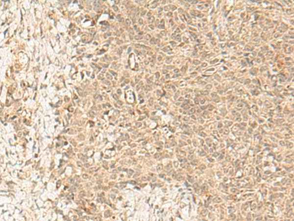 Anti-Human/Mouse FBXL4 Antibody