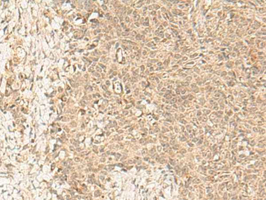 Anti-Human/Mouse FBXL4 Antibody