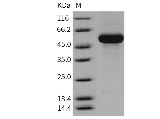 Recombinant Human CD131/CSF2RB Protein (His Tag) - ABMIUM