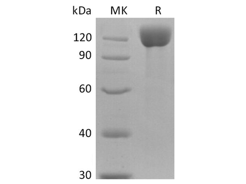 Recombinant Human APN Protein (His Tag) - ABMIUM