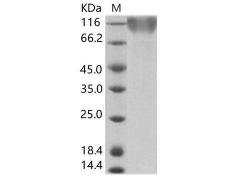 Recombinant Epstein-Barr virus (Herpesvirus 4) EBV Glycoprotein gp350 / EBV GP350 Protein (His Tag) - ABMIUM