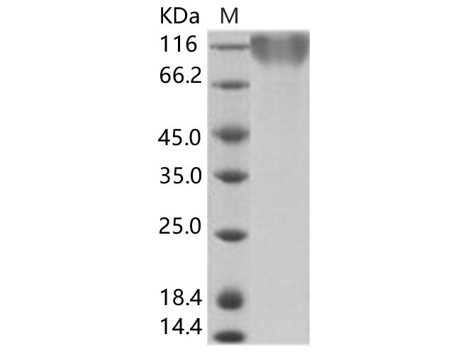 Recombinant Epstein-Barr virus (Herpesvirus 4) EBV Glycoprotein gp350 / EBV GP350 Protein (His Tag) - ABMIUM