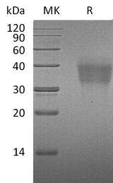 Recombinant Mouse PD-1/PDCD1 Protein (His Tag) - ABMIUM