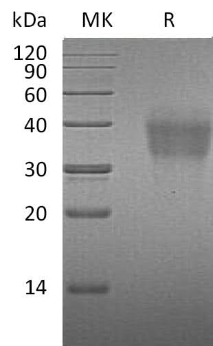Recombinant Mouse PD-1/PDCD1 Protein (His Tag) - ABMIUM