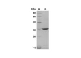 SDS-PAGE analysis of Mouse NT-PROBNP proteins, 2 μg/lane of Recombinant Mouse NT-PROBNP proteins was resolved with SDS-PAGE under reducing conditions, showing bands at 30 kDa.