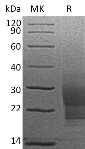 Recombinant Mouse SCF/c-Kit Ligand Protein (His Tag) - ABMIUM