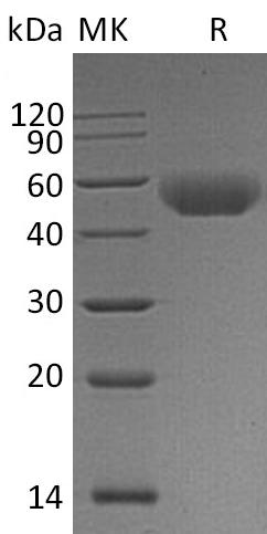 Recombinant Mouse CD5 Protein (aa 24-370, His Tag) - ABMIUM