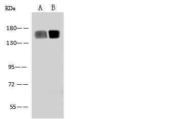 Anti-Human ANPEP Antibody [A1015] - ABMIUM