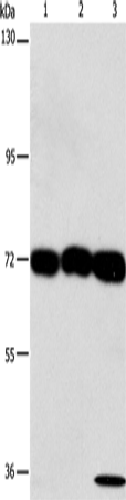 Anti-Human/Mouse CKAP4 Antibody - ABMIUM