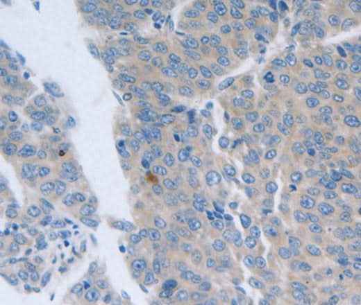 Anti-Human/Mouse/Rat GRIN1 Antibody