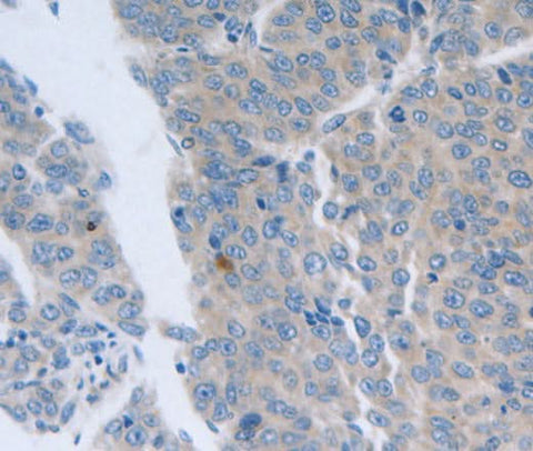 Anti-Human/Mouse/Rat GRIN1 Antibody - ABMIUM