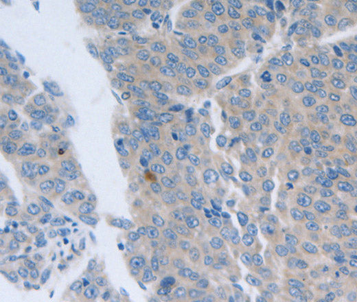 Anti-Human/Mouse/Rat GRIN1 Antibody - ABMIUM