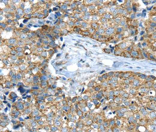 Anti-Human IFNA2 Antibody