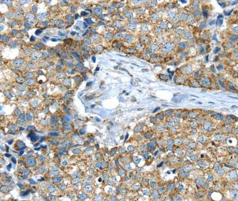 Anti-Human IFNA2 Antibody