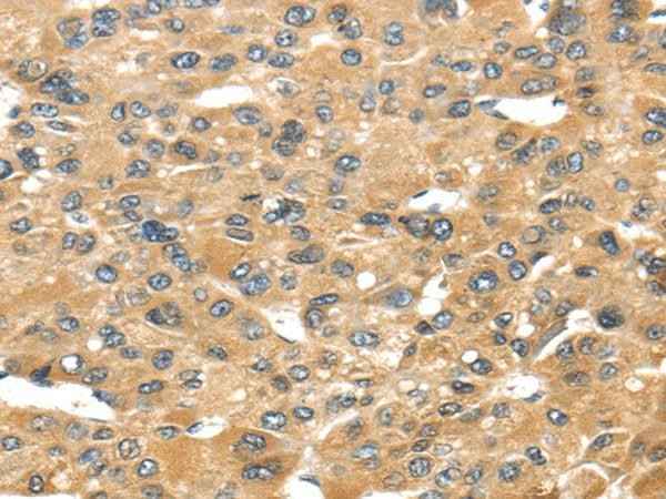 Anti-Human UCP1 Antibody
