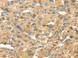 Anti-Human UCP1 Antibody - ABMIUM