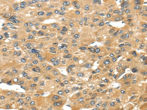 Anti-Human UCP1 Antibody - ABMIUM